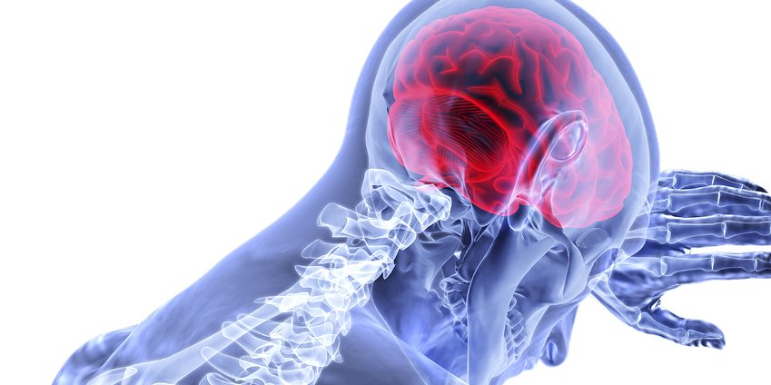 Skeleton focusing on traumatic brain injury. Personal injury lawyer in Whitby, Vaughan, and GTA.